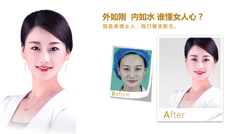 十堰V脸、线雕隆鼻